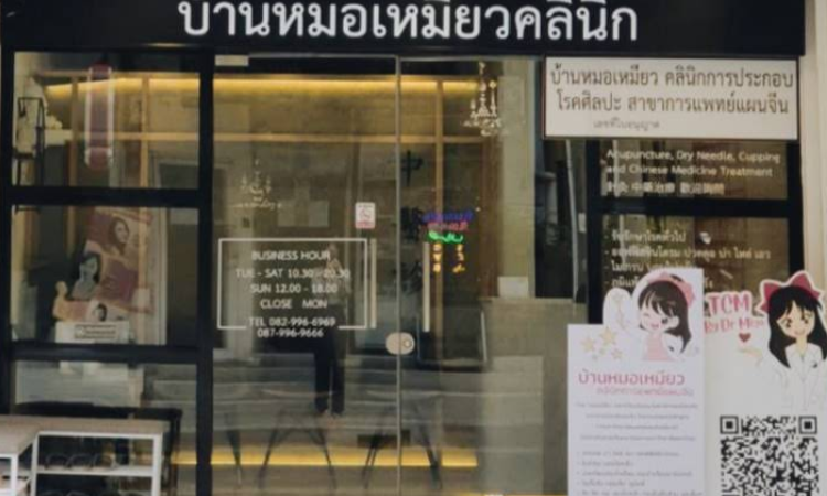 ฝังเข็ม